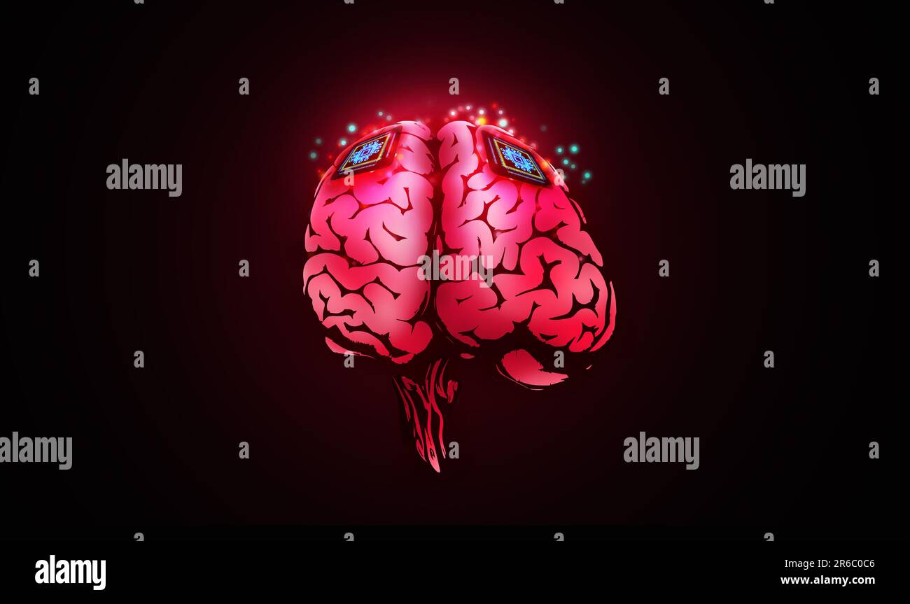 Microchips are implanted in human brain. Neural implants. Brain