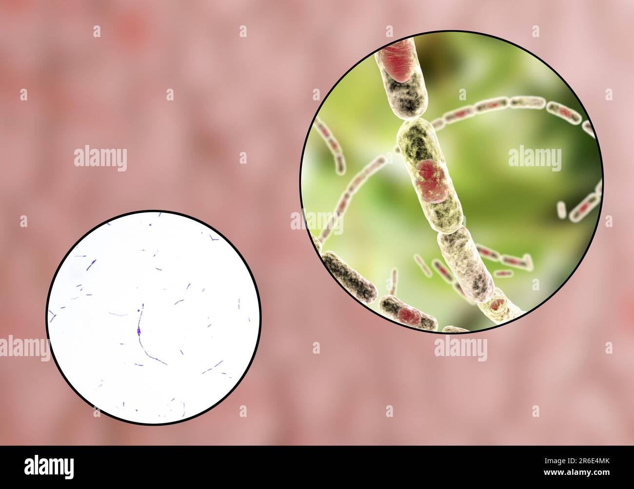 Anthrax bacteria, light micrograph and computer illustration. Anthrax bacteria (Bacillus anthracis) are the cause of the disease anthrax in humans and Stock Photo