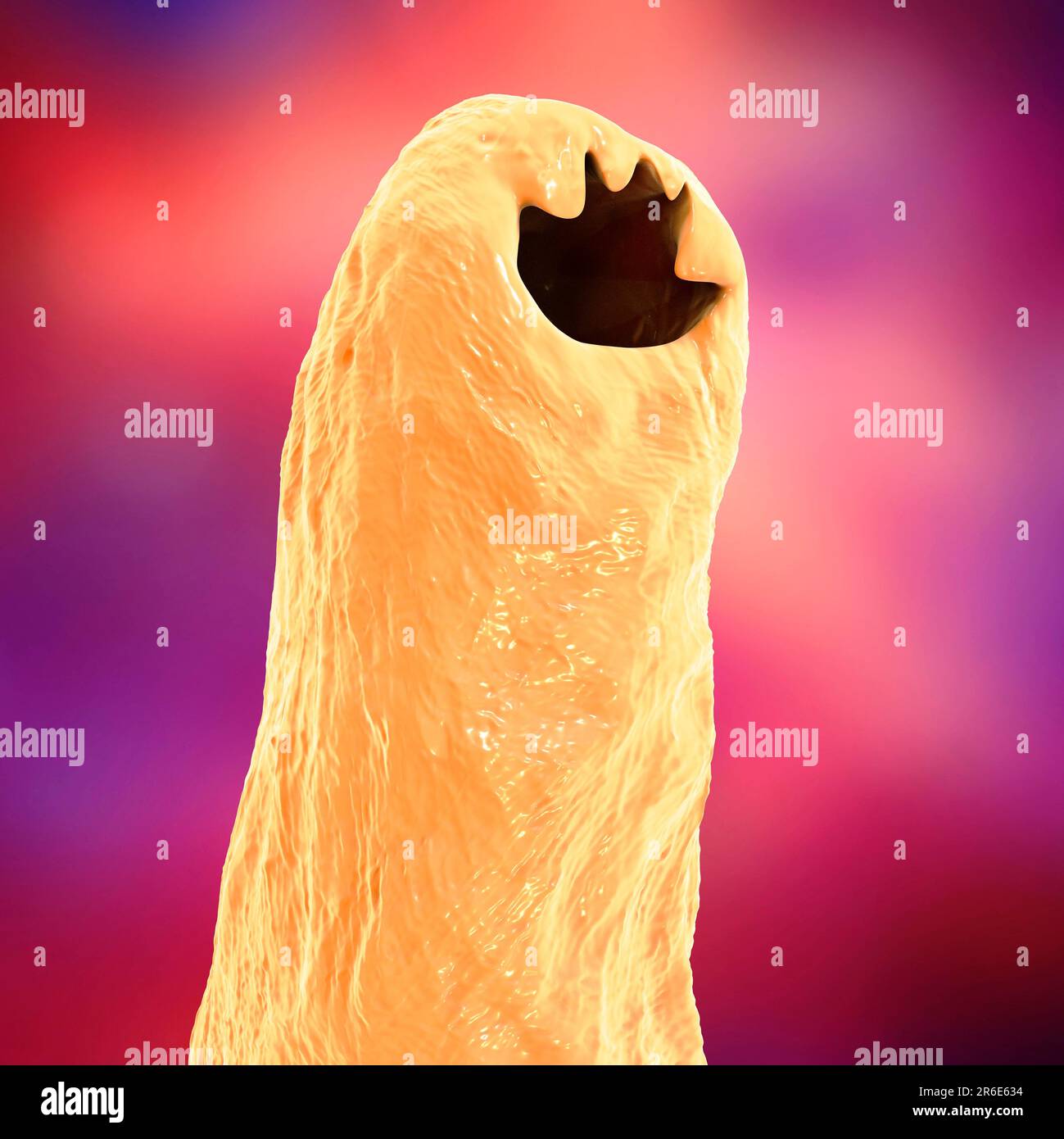 Hookworm head. Computer illustration of the head of the parasitic