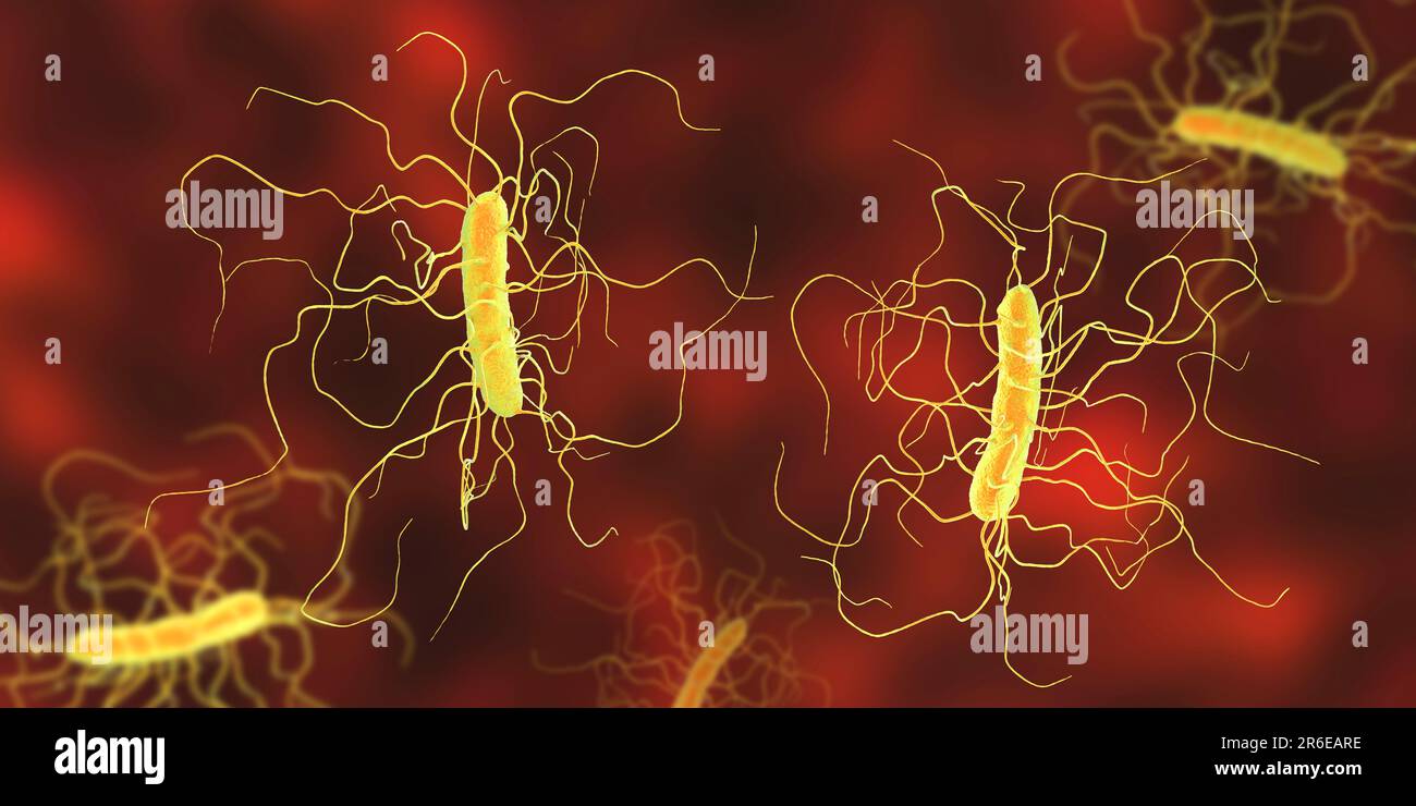 Clostridium Difficile Spore Stain