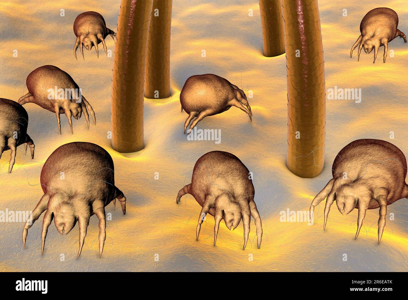 Dust mites (Dermatophagoides pteronyssinus) on human skin, computer