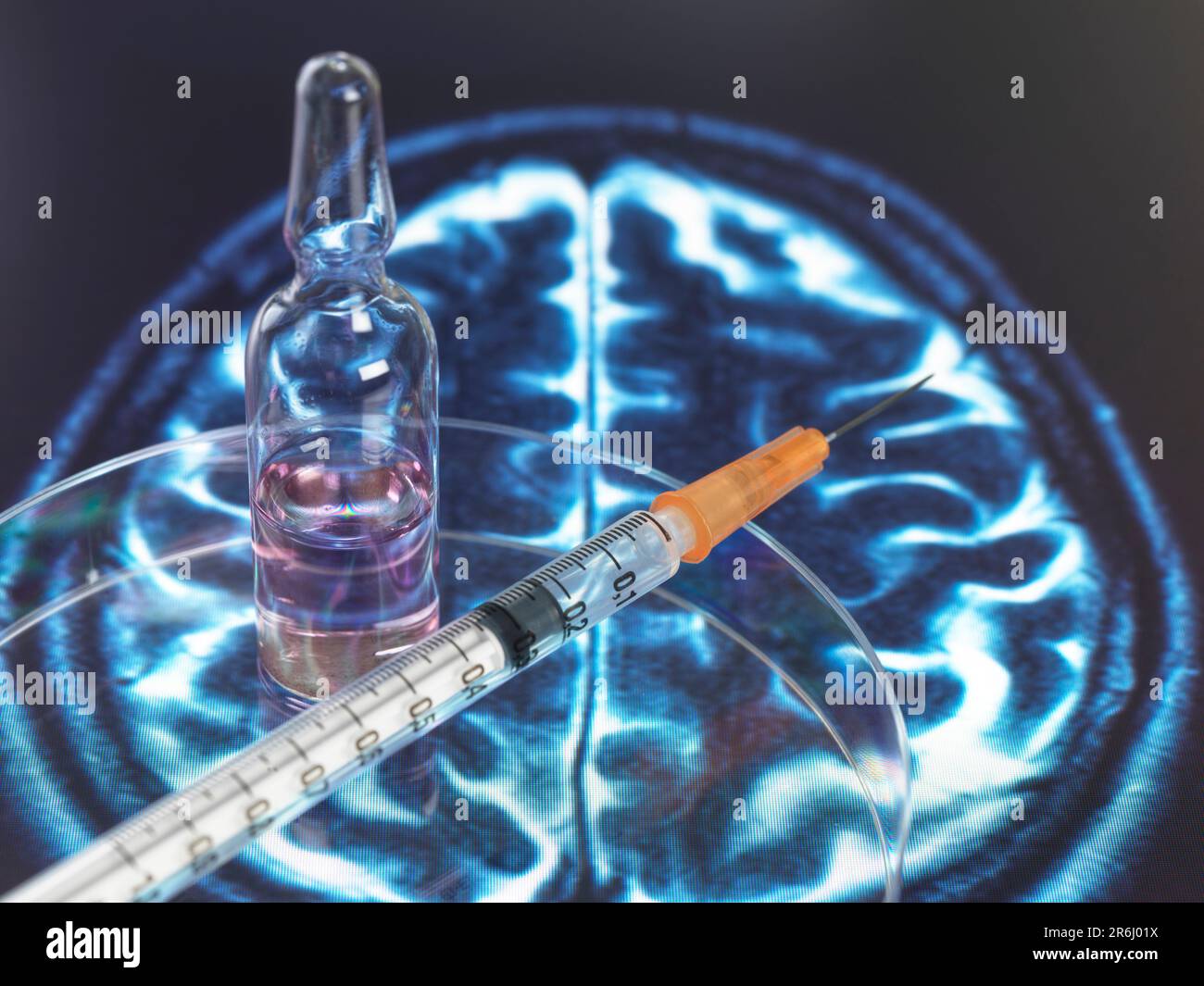 Dementia brain scan hi-res stock photography and images - Alamy