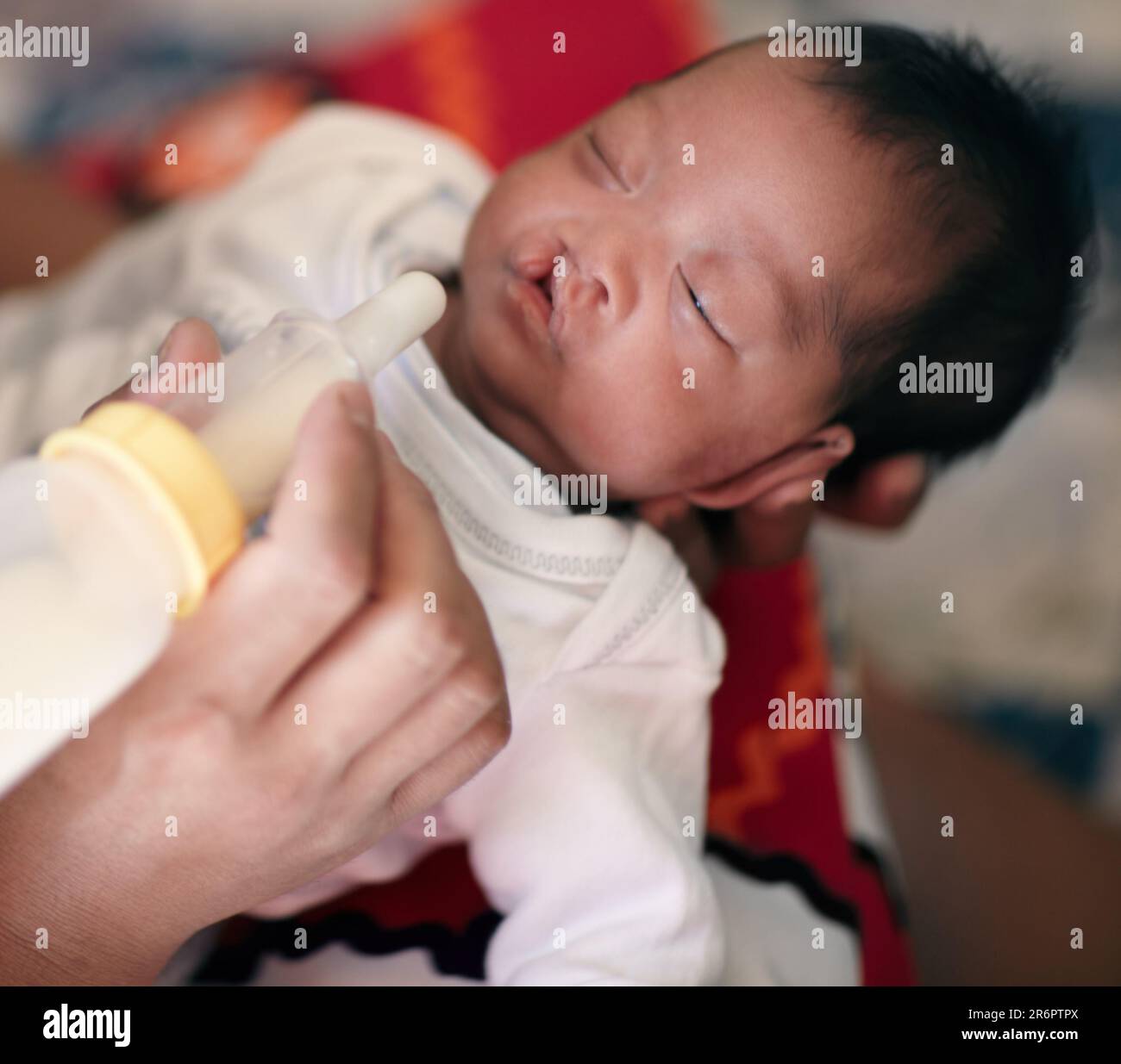 Baby with cleft lip, milk and mother feeding from bottle for nutrition