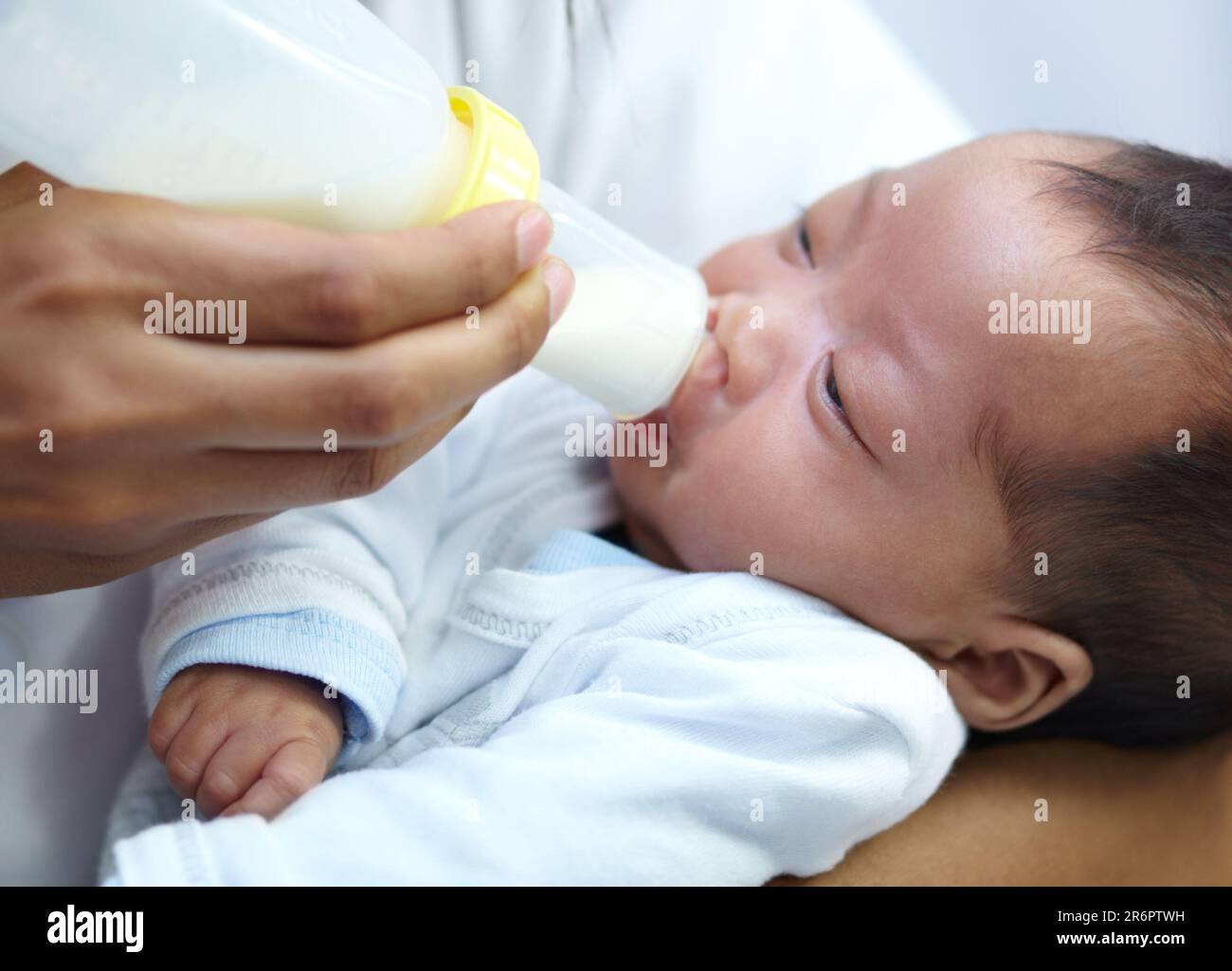 Baby with cleft lip, milk and mom feeding from bottle for nutrition