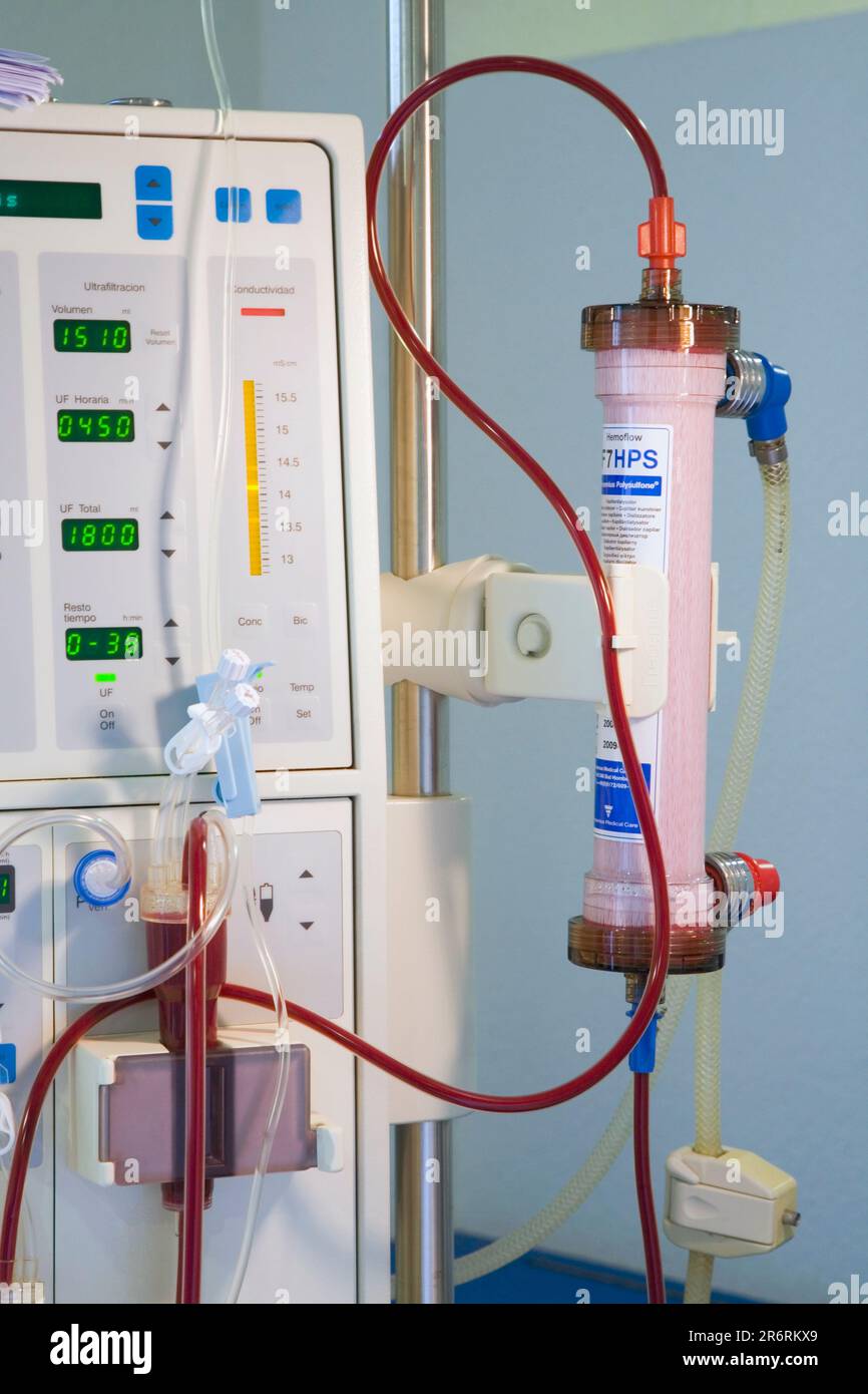 Dialyzer or artificial kidney which filters patients blood during hemodialysis session Stock