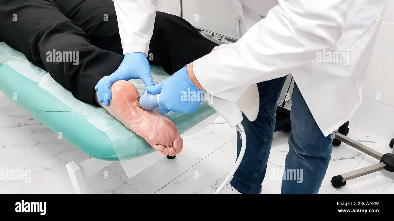 Extracorporeal shock wave therapy ESWT of heel. Visit to office of orthopedic surgeon doctor. Effective non-surgical treatment, pain relief. Physical Stock Photo