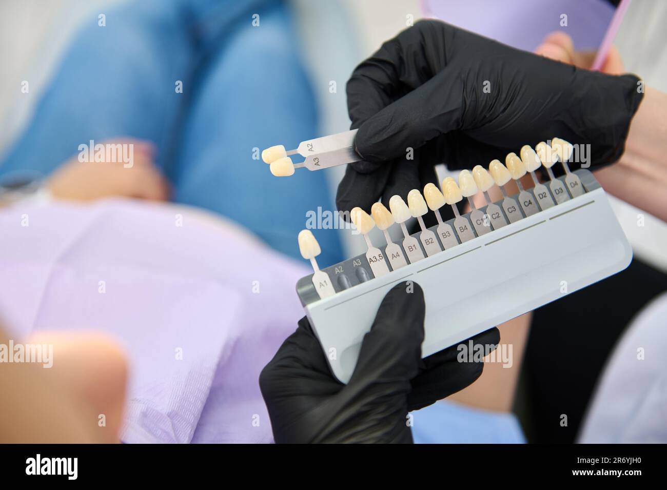 Closeup dentist's hands hold tooth color chart, Vita scale, teeth