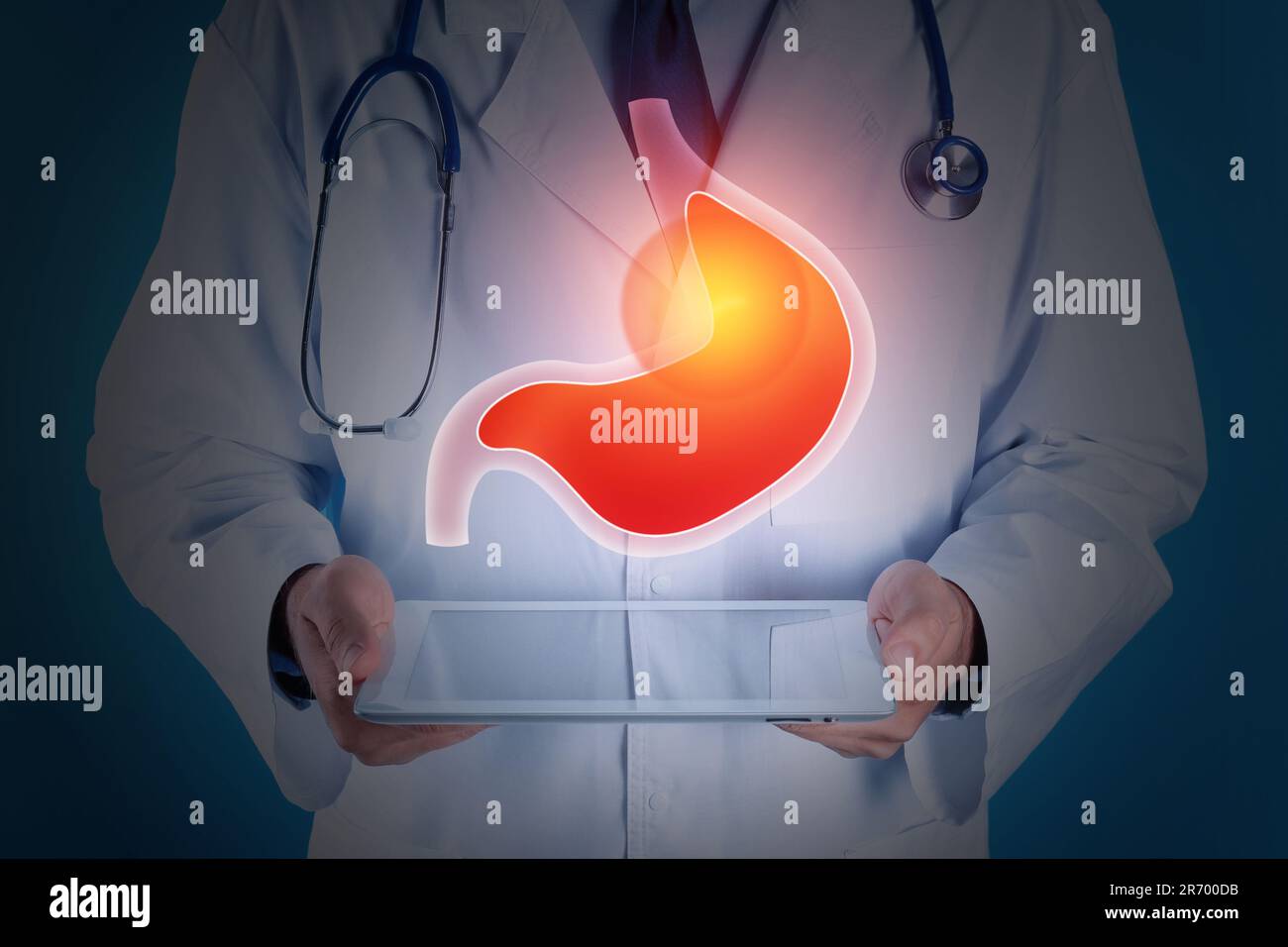 Treatment of heartburn and other gastrointestinal diseases. Doctor using tablet on dark background, closeup. Stomach illustration over device Stock Photo