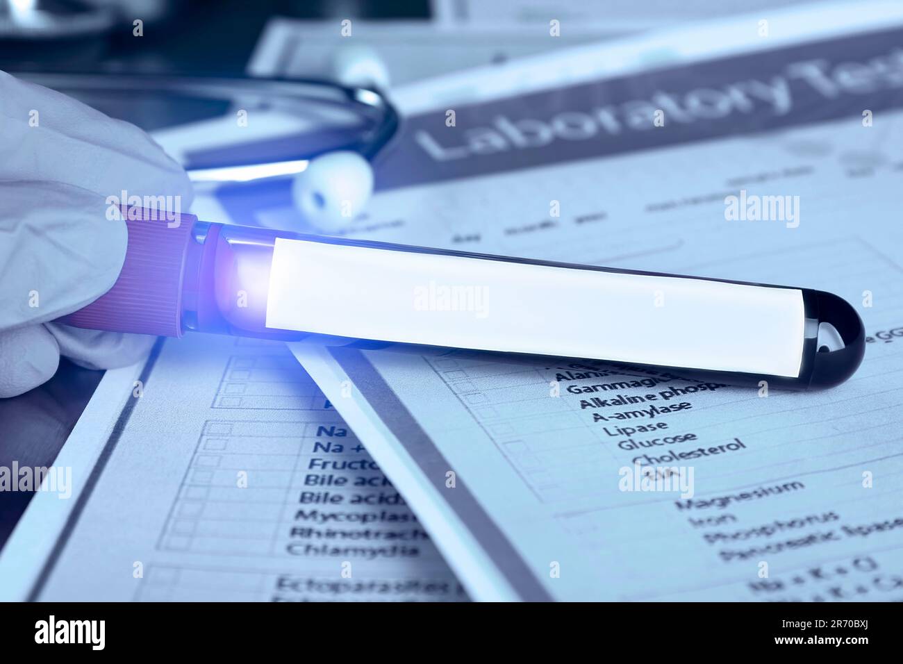 Laboratory worker holding test tube with blood sample over medical form