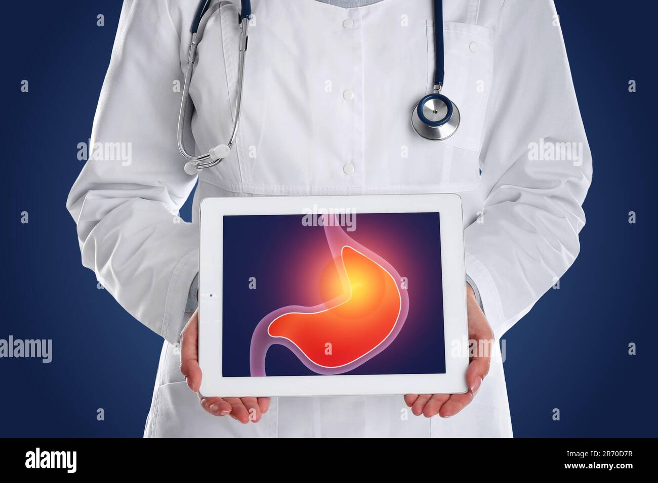 Treatment of heartburn and other gastrointestinal diseases. Doctor with tablet on dark blue background, closeup. Stomach illustration on screen Stock Photo