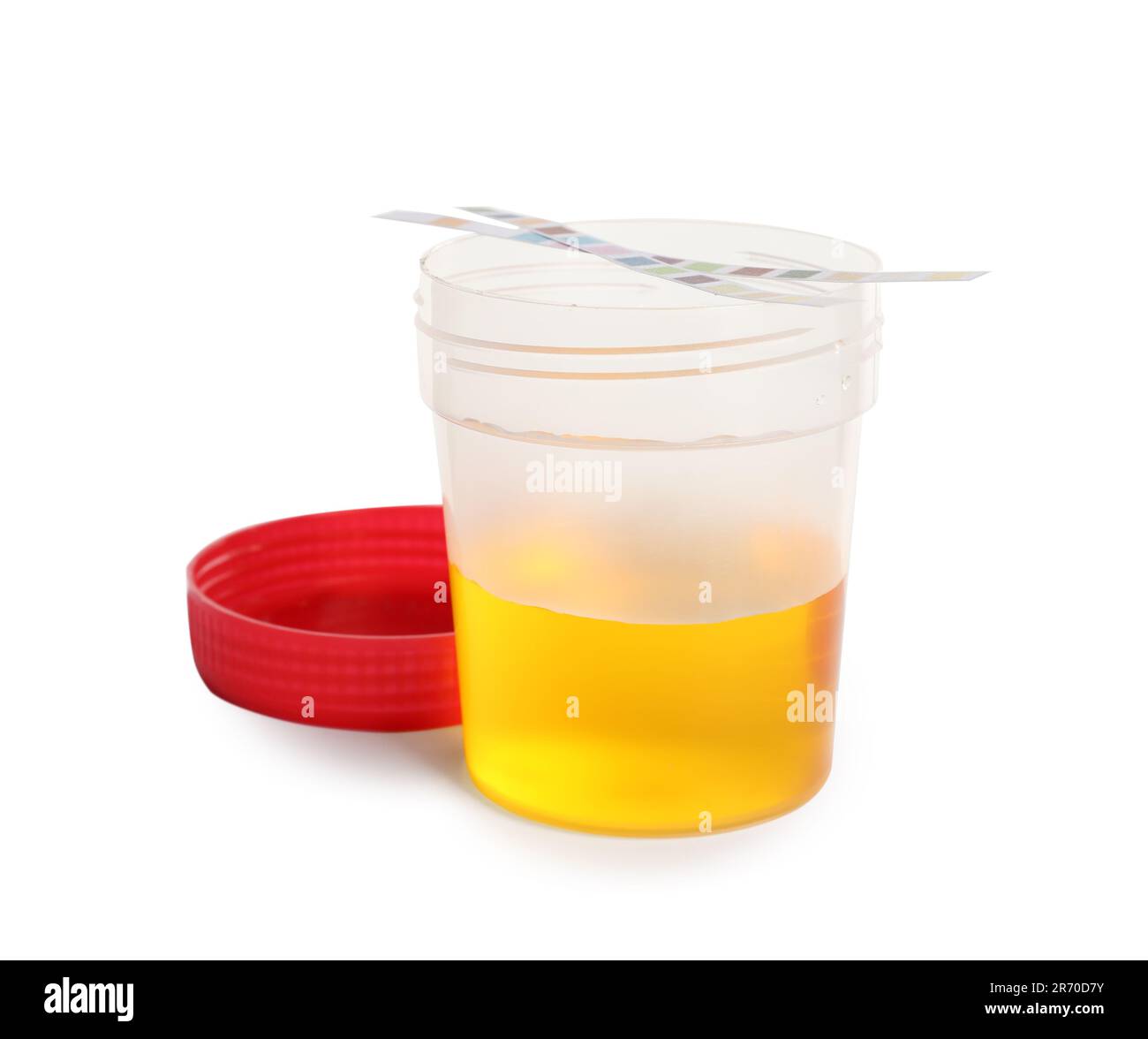 Container with urine sample for analysis and test strips on white