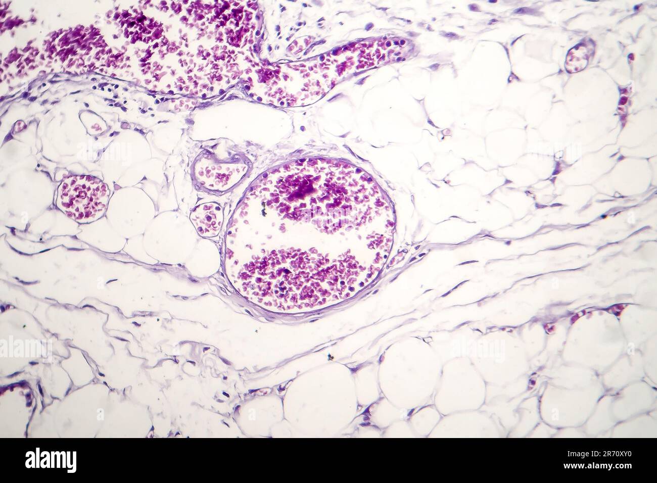 Blood vessels with red blood cells, transevrse section, light