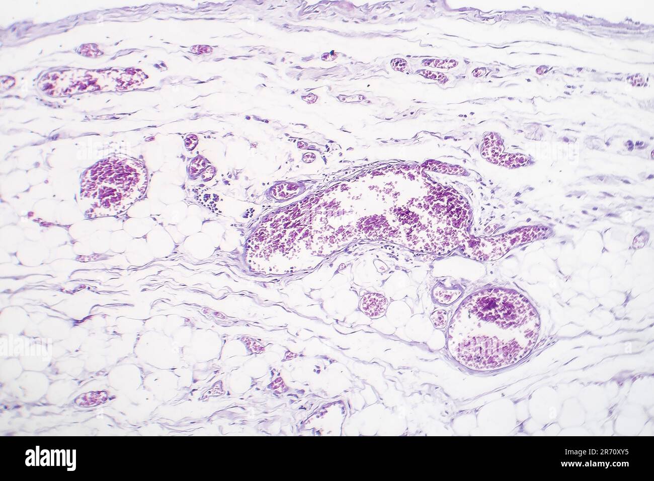 Blood Vessel Under Microscope Labeled at Juan Maguire blog