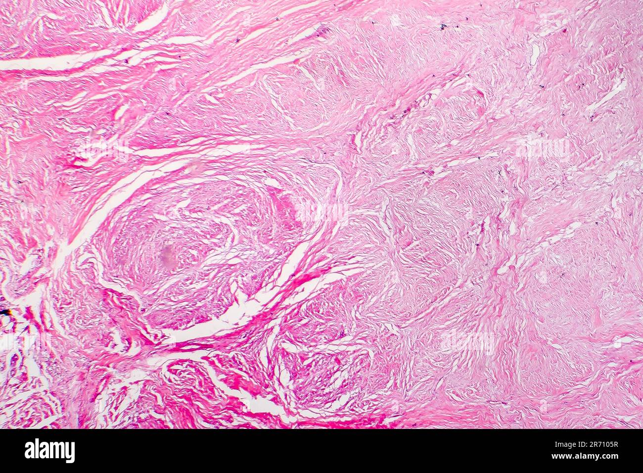 Light micrograph of scar tissue. Photo under microscope of a scar ...