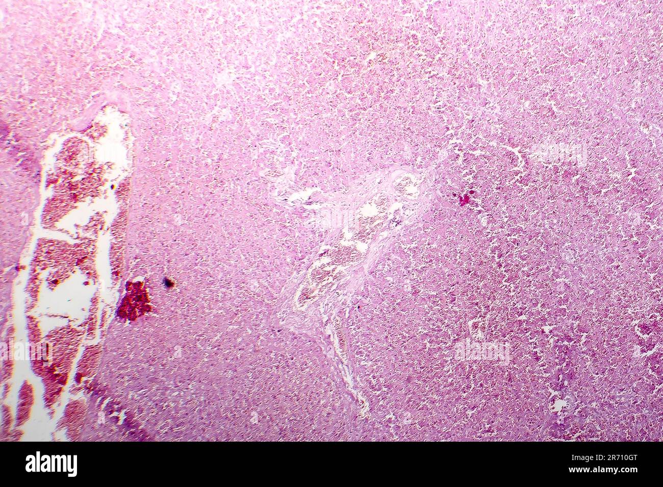 Acute hepatic congestion, light micrograph, an acute consequence of ...