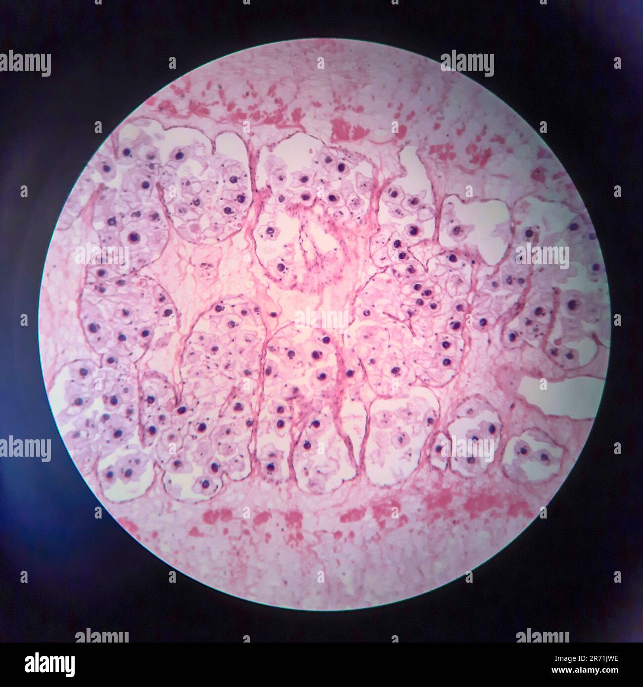 Pork tapeworm Taenia solium, section through the body, light micrograph Stock Photo