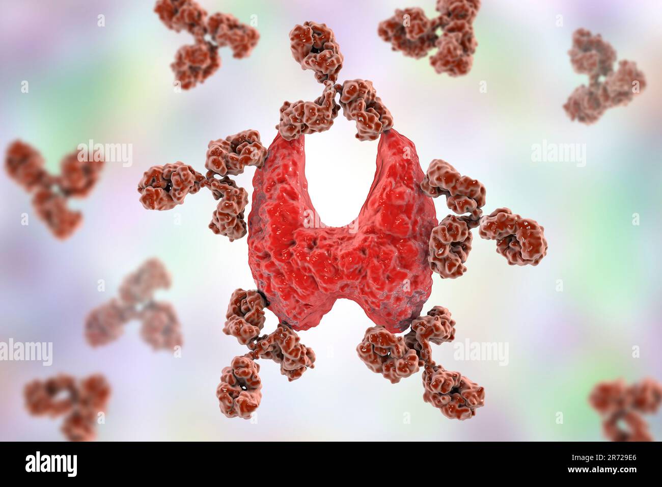 Autoimmune thyroiditis (Hashimoto's disease), conceptual image