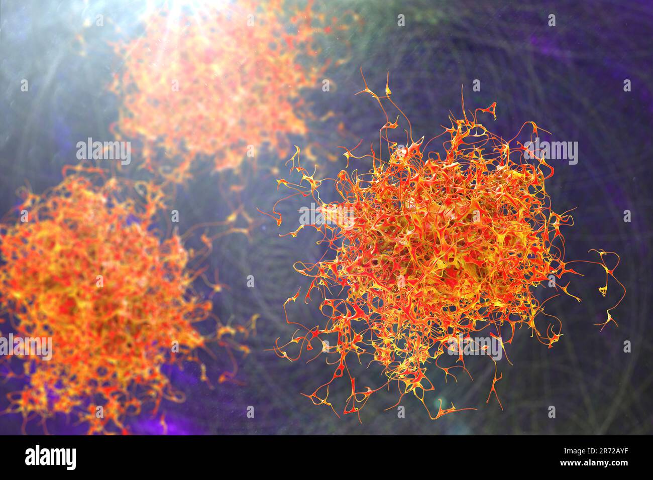 Cancer cells, computer illustration Stock Photo - Alamy