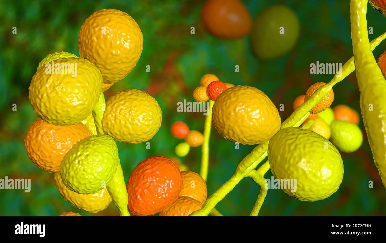Computer illustration of Candida fungi (yeast). The most common