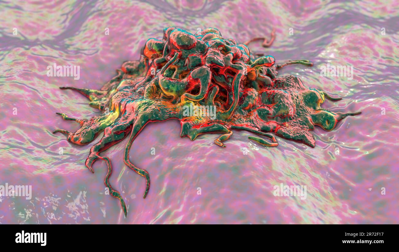 Cancer cell, computer illustration Stock Photo - Alamy