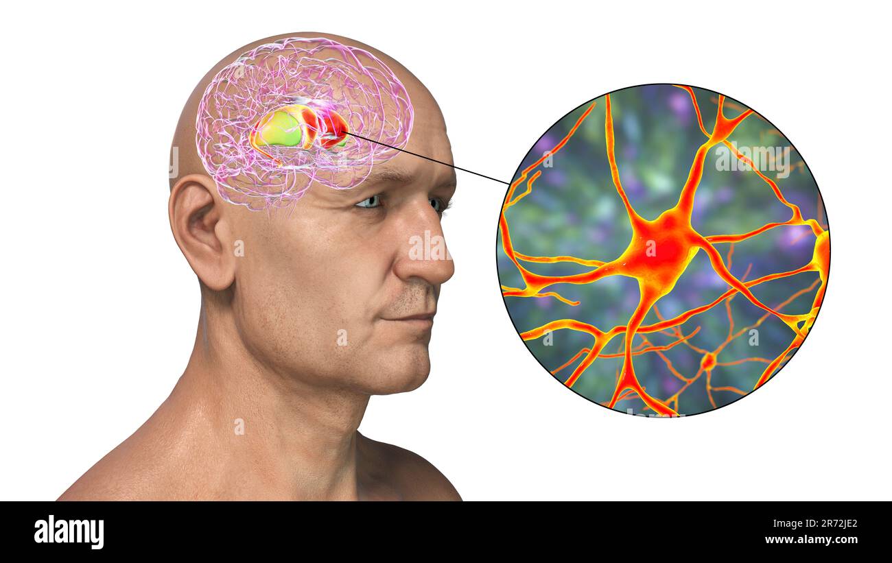 Dorsal striatum highlighted in human brain and closeup view of its