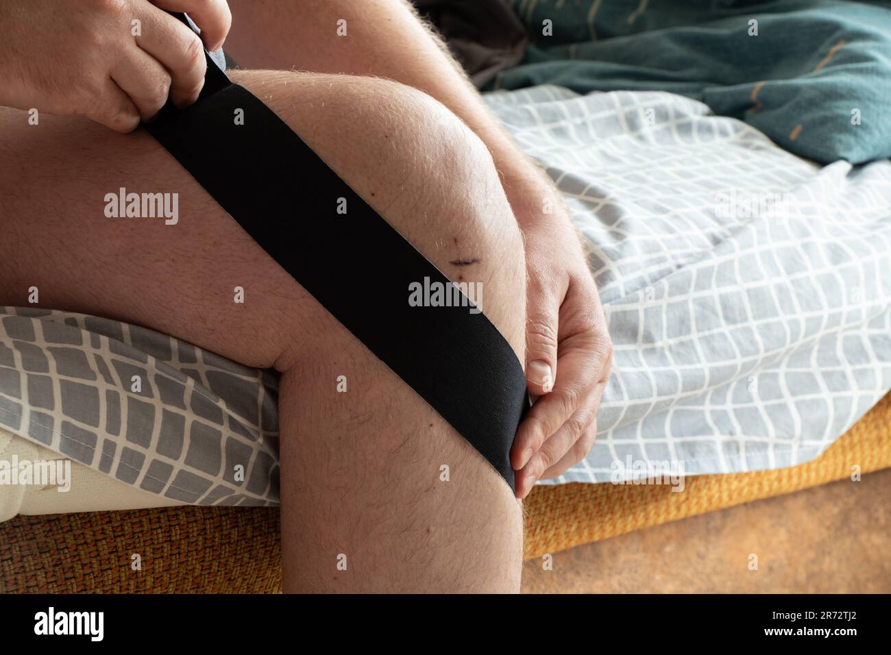 Knee taping after knee surgery and meniscus replacement, rehabilitation and recovery after surgery Stock Photo