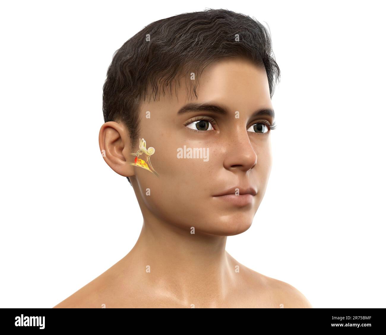 Otitis media, a group of inflammatory diseases of the middle ear. Computer illustration showing a boy with highlighted structures of the middle and in Stock Photo