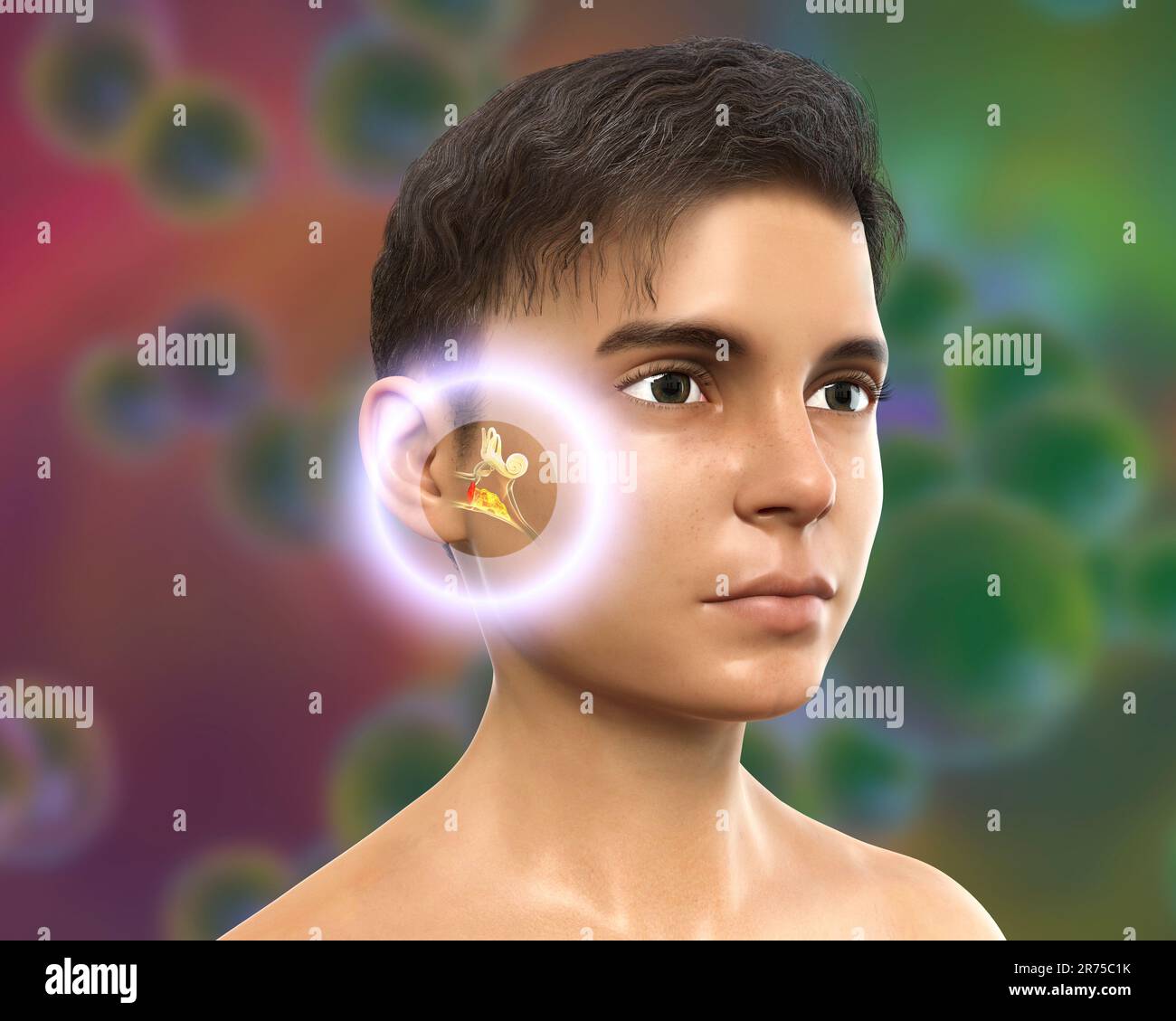 Otitis media, a group of inflammatory diseases of the middle ear. Computer illustration showing a boy with highlighted structures of the middle and in Stock Photo