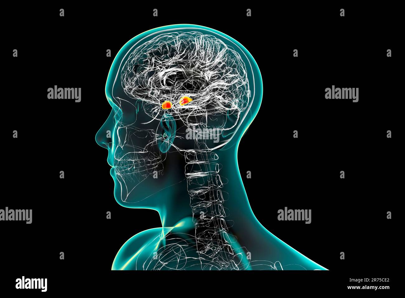 Amygdala, also known as corpus amygdaloideum, in the brain, computer