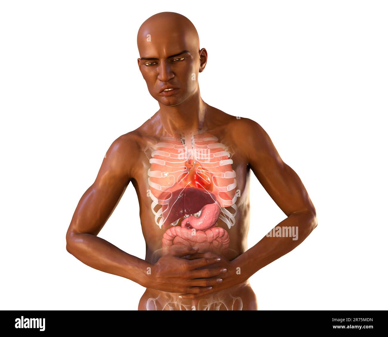 Pain in stomach, conceptual computer illustration. Darkskinned man