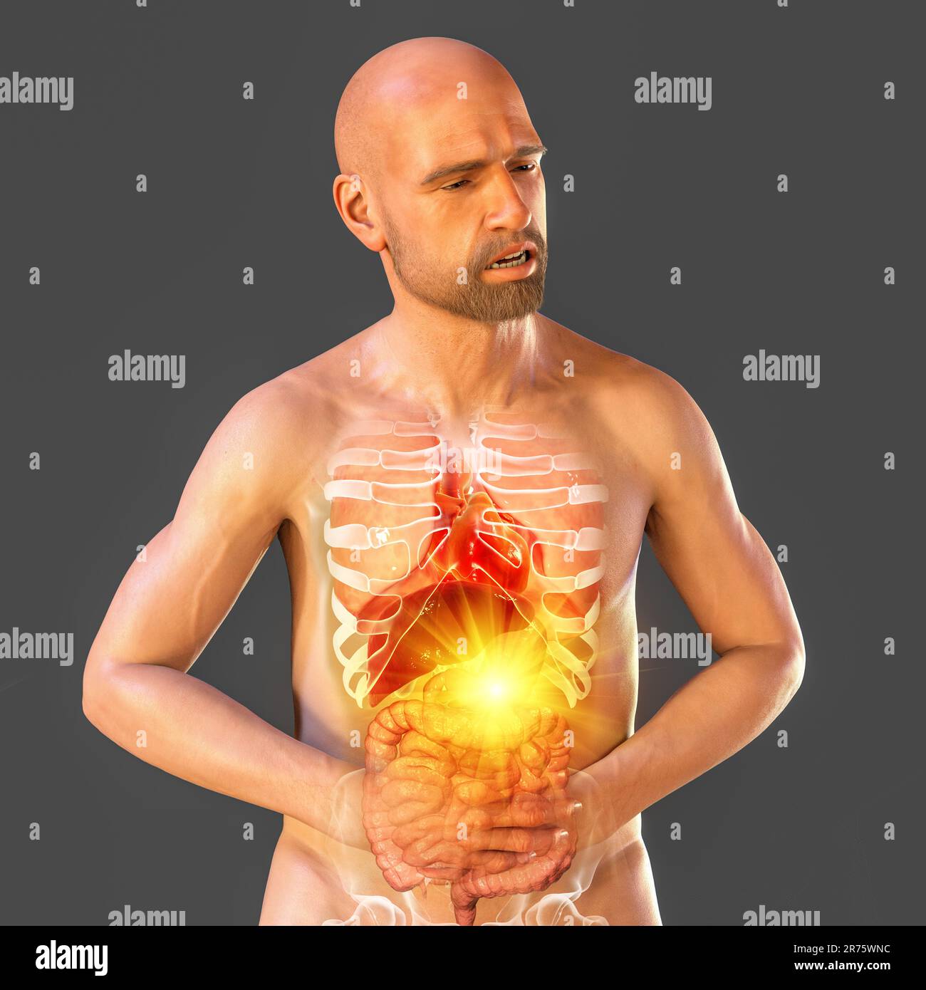 Pain in stomach, conceptual computer illustration. A man suffering from