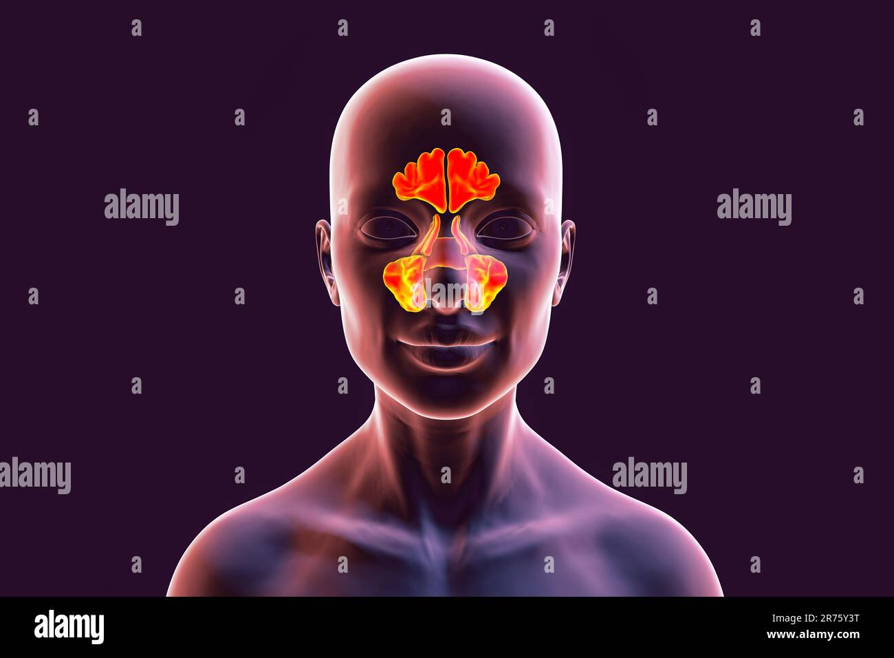Human paranasal sinuses, computer illustration. The sinuses are