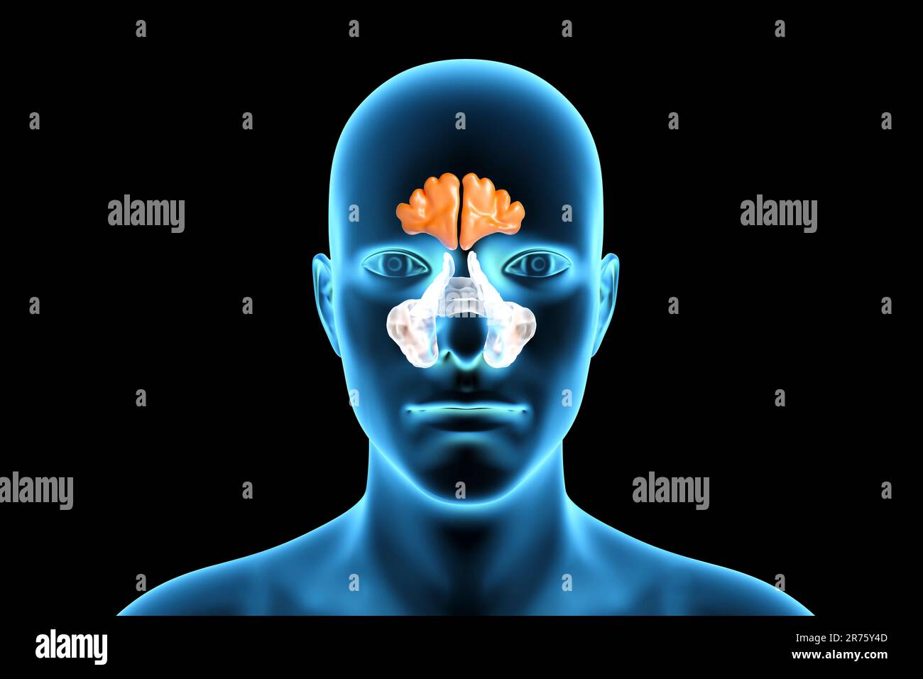 Human paranasal sinuses, computer illustration. The sinuses are