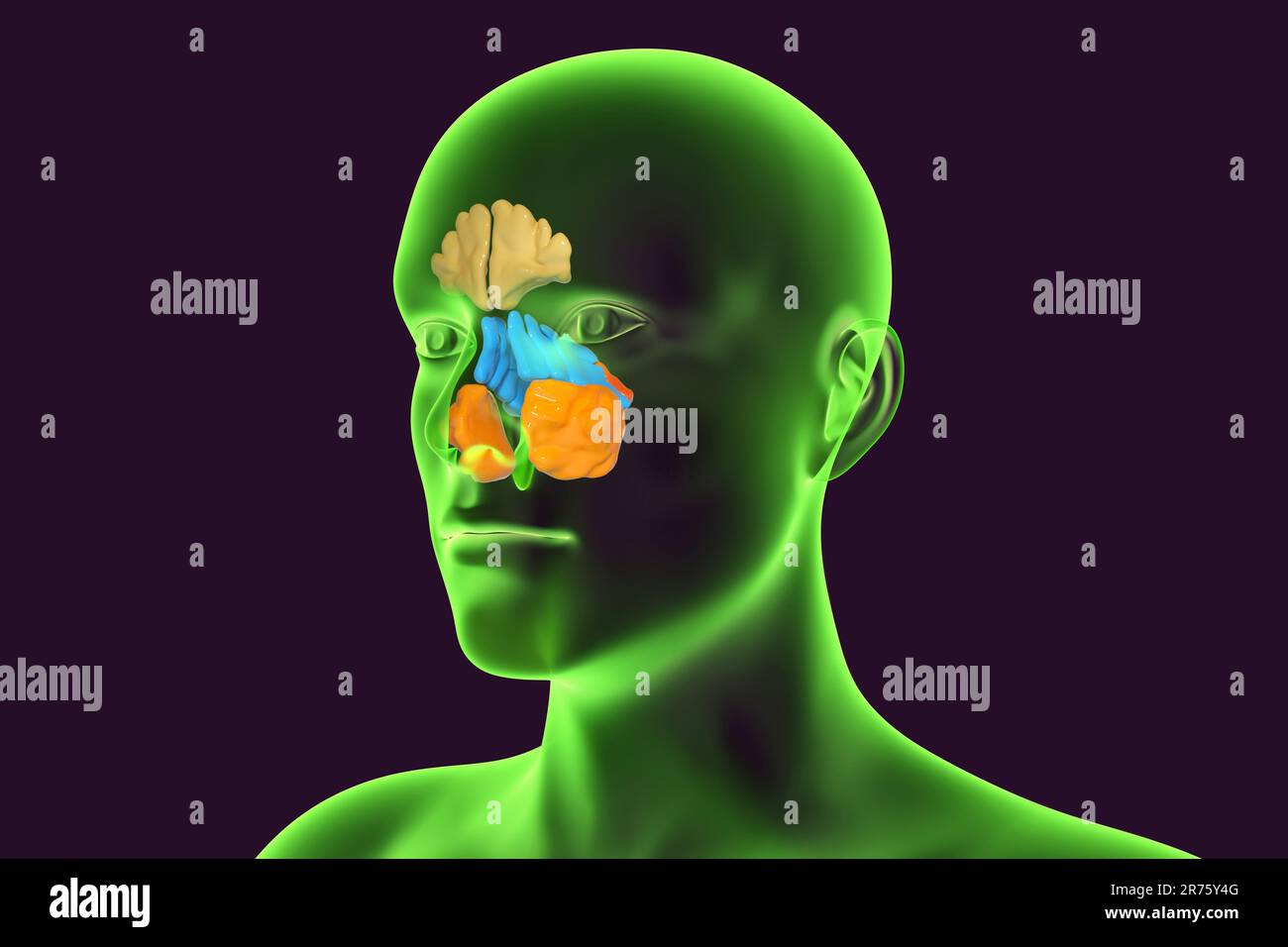 Human paranasal sinuses, computer illustration. The sinuses are