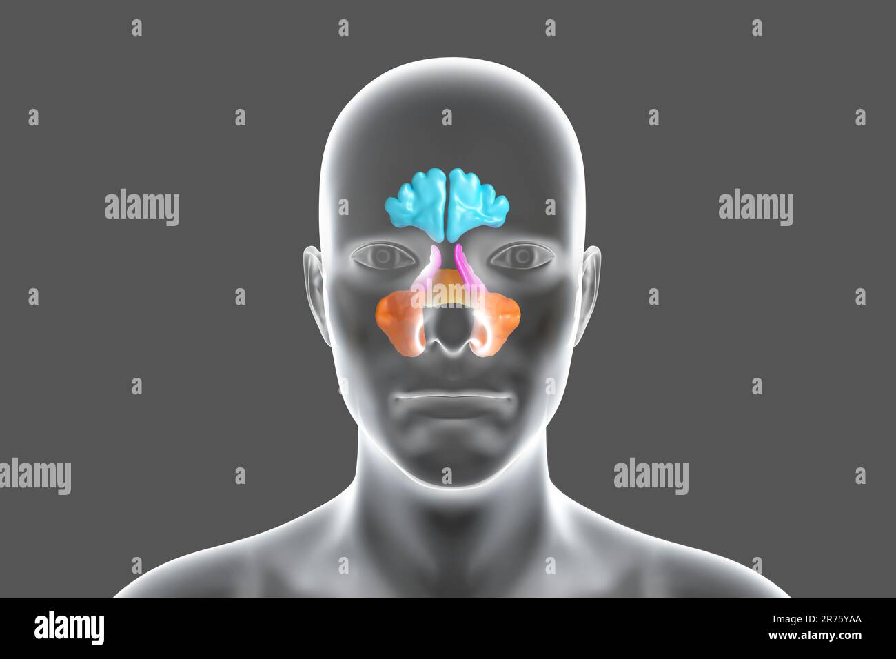 Human paranasal sinuses, computer illustration. The sinuses are