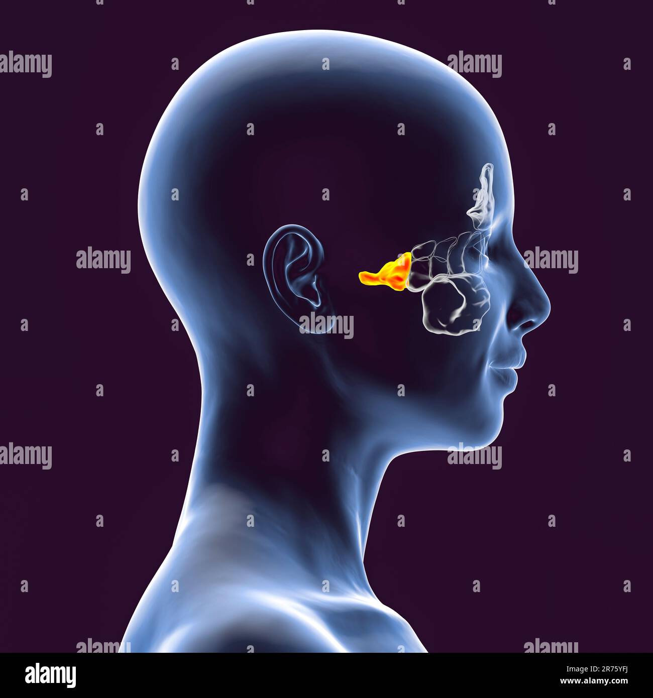 Human Paranasal Sinuses Computer Illustration The Sinuses Are Membrane Lined Air Filled Spaces 5523