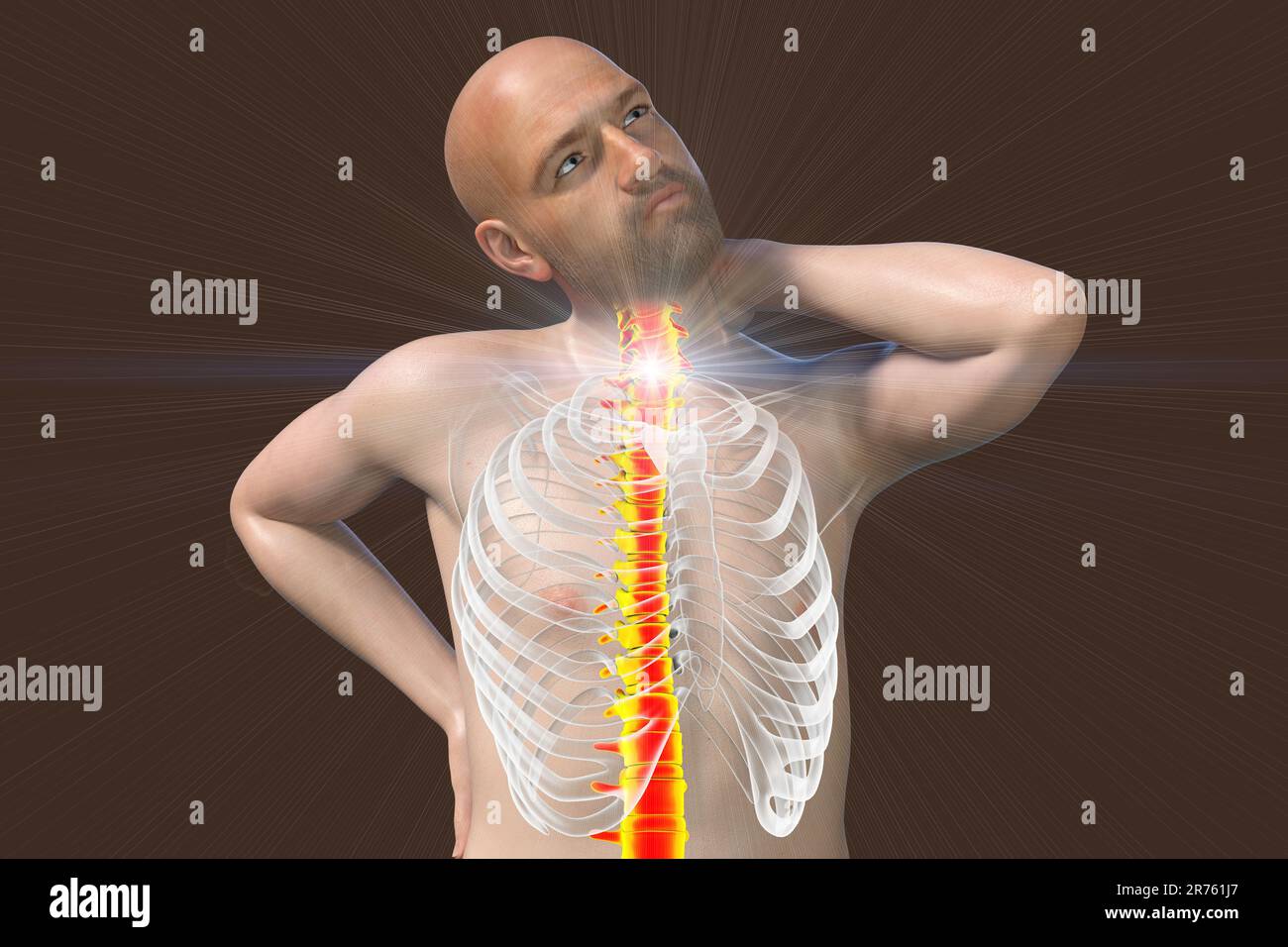Human neck pain, computer artwork Stock Photo Alamy