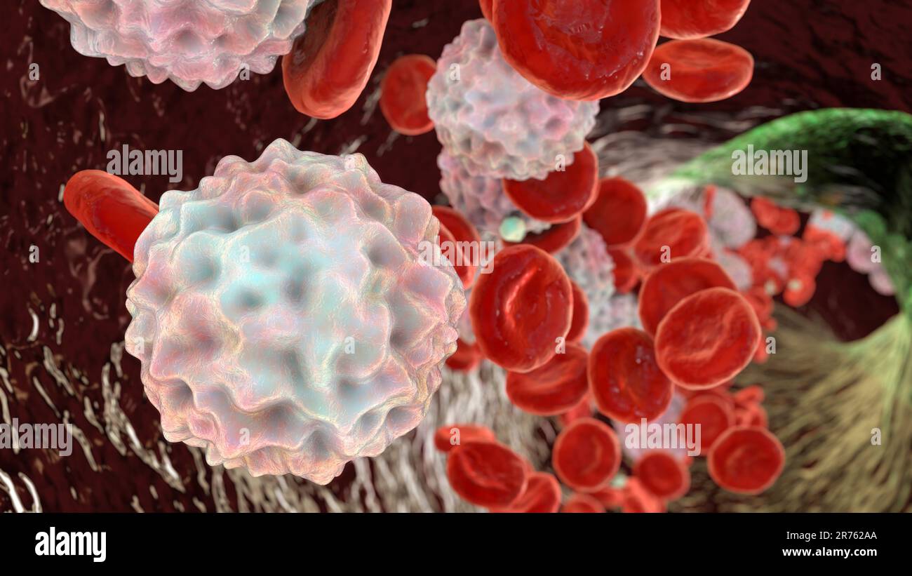 Lymphocytosis, leukocytosis, computer illustration showing abundant white blood cells inside blood vessel. Stock Photo