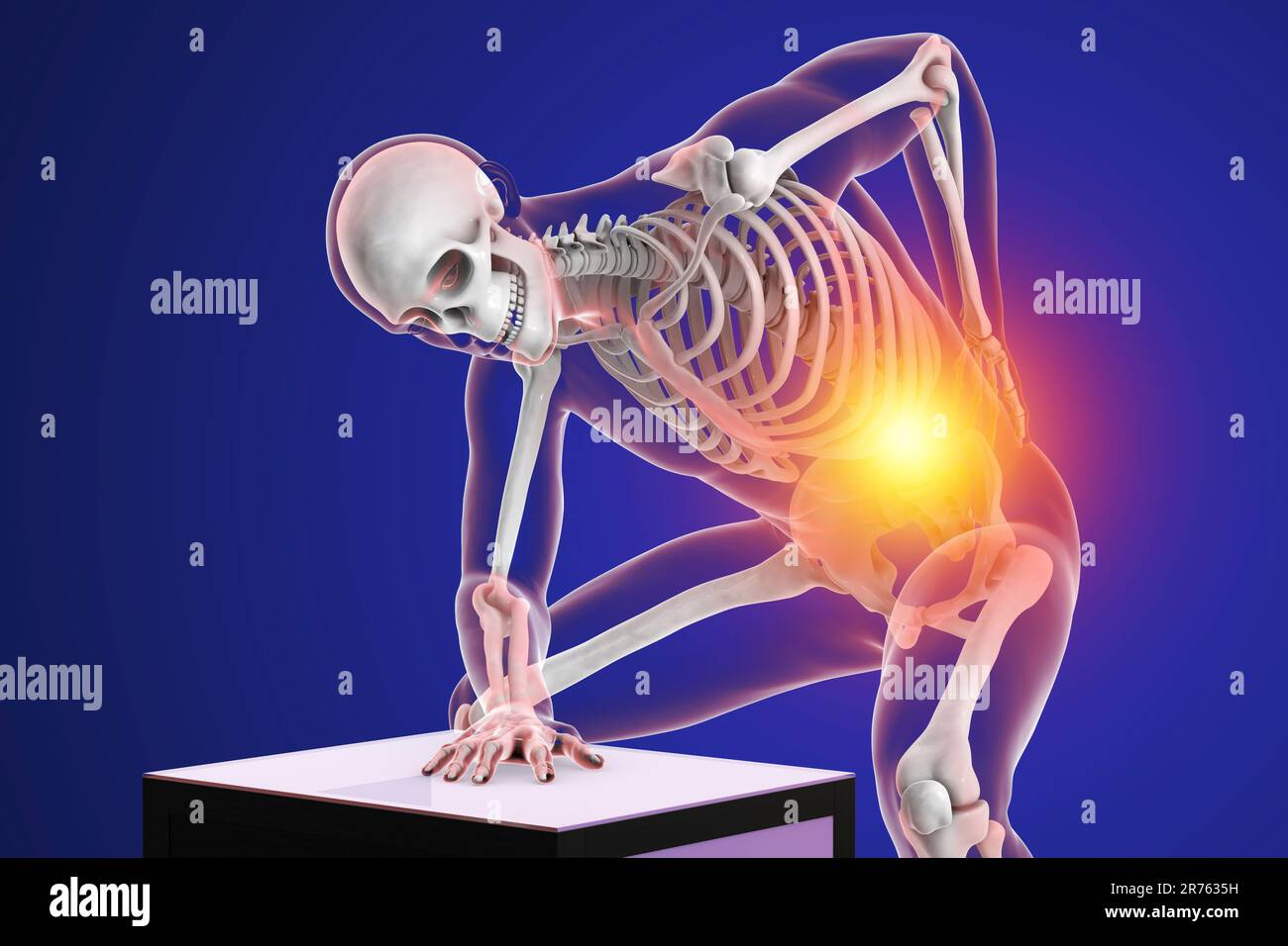 Back pain. Conceptual computer artwork of a human body with highlighted