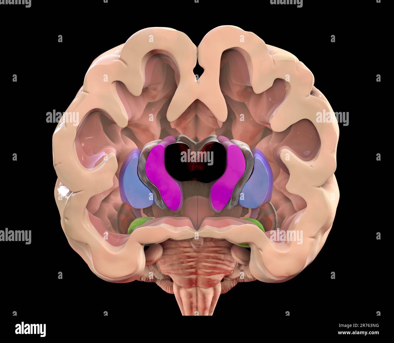Illustration of the dorsal striatum and lateral ventricles in