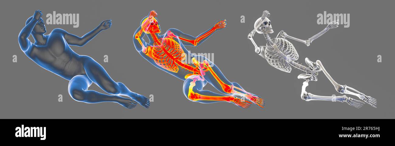 Human male body with skeleton in a bad feeling unconsciousness position ...
