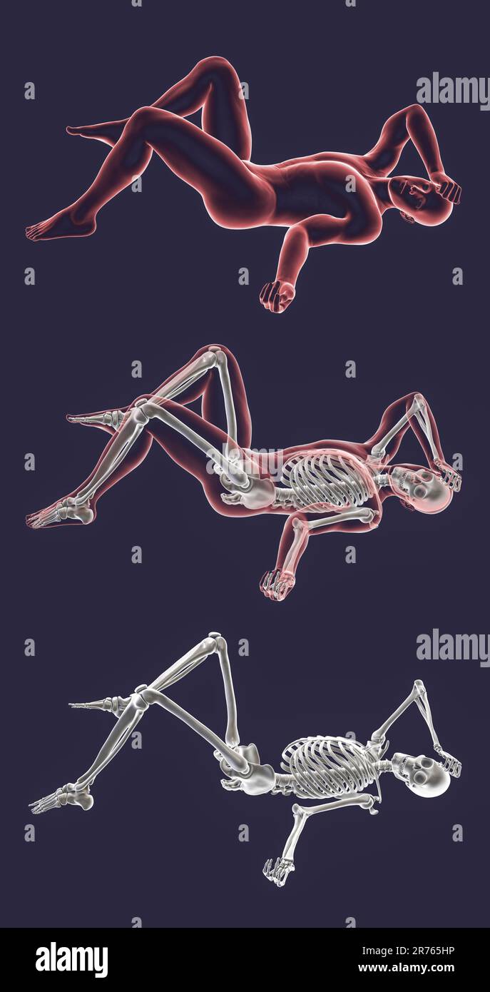 Human male body with skeleton in a bad feeling unconsciousness position ...