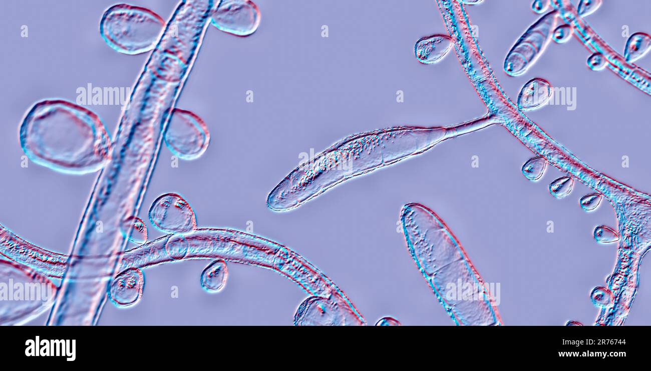 Fungus Trichophyton rubrum, computer illustration showing macroconidia, microconidia and septate hyphae. T. rubrum is an anthropophilic dermatophyte. Stock Photo