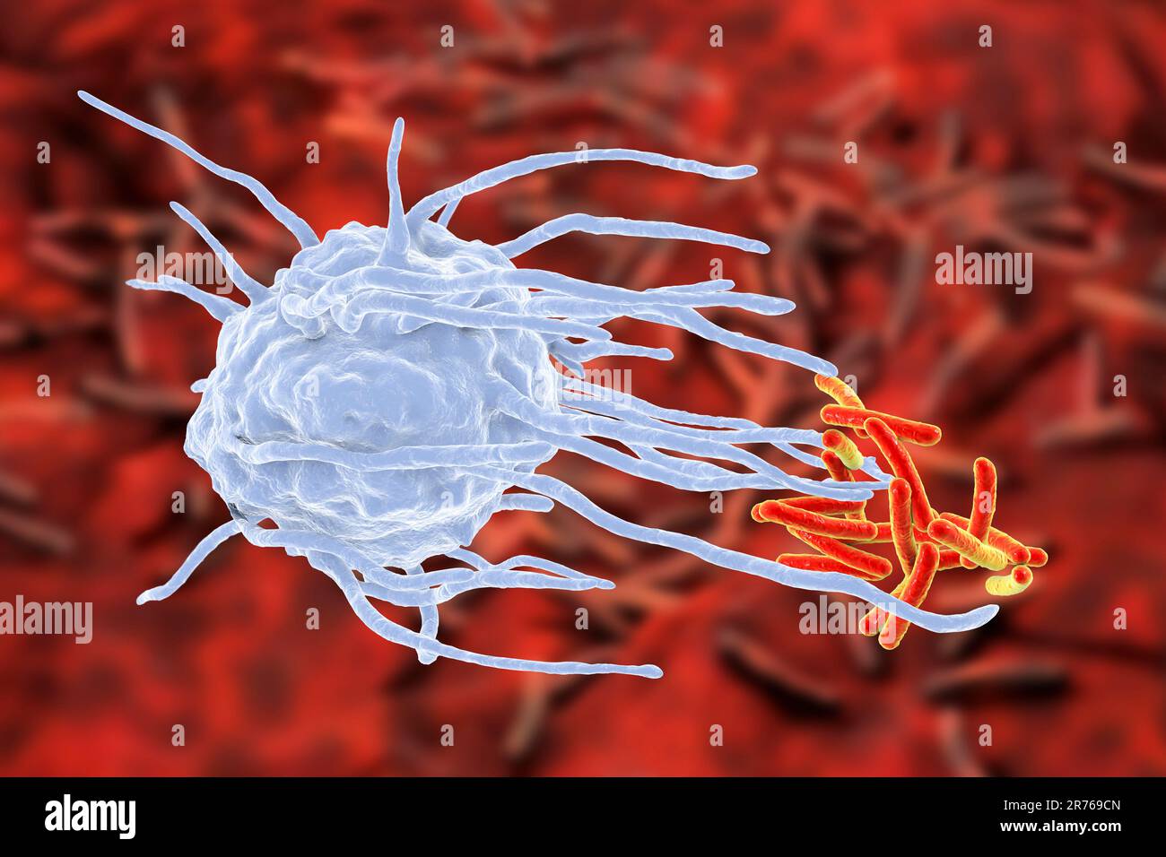 Macrophage engulfing TB bacteria. Computer illustration of a macrophage ...