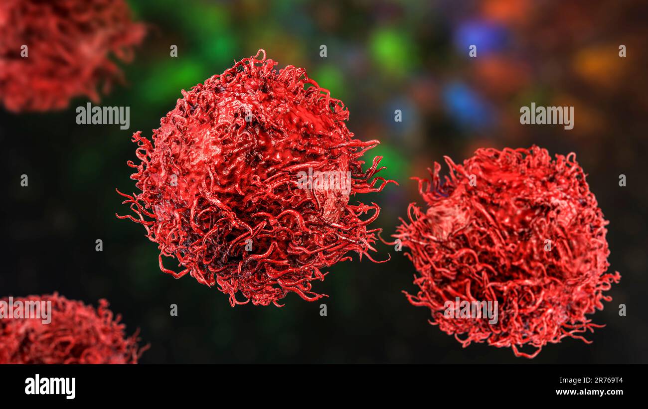 Stomach cancer cells, computer artwork Stock Photo - Alamy