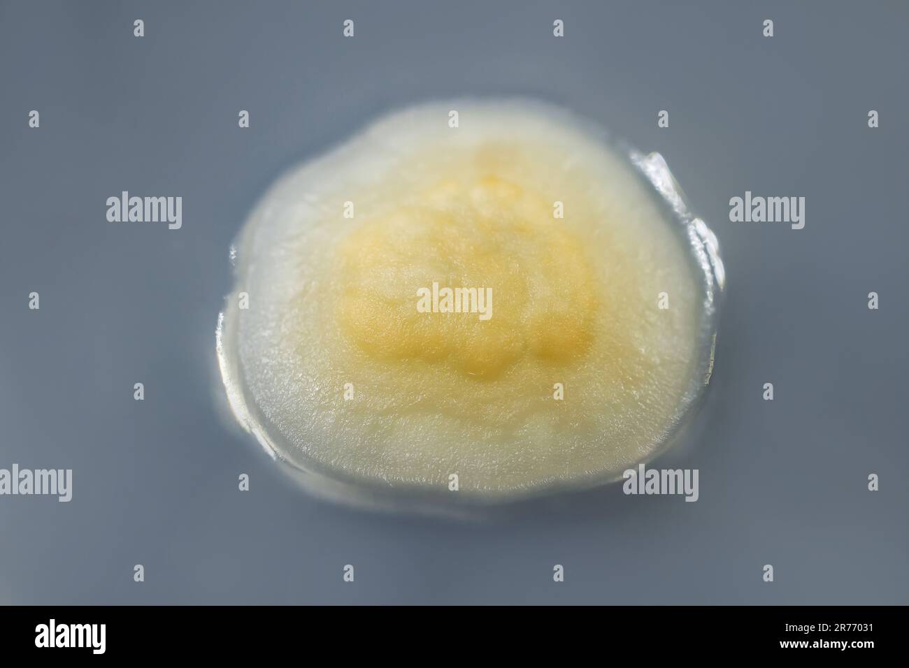 Colony of a mold fungus cultivated from indoor air on Sabourad dextrose agar. Stock Photo