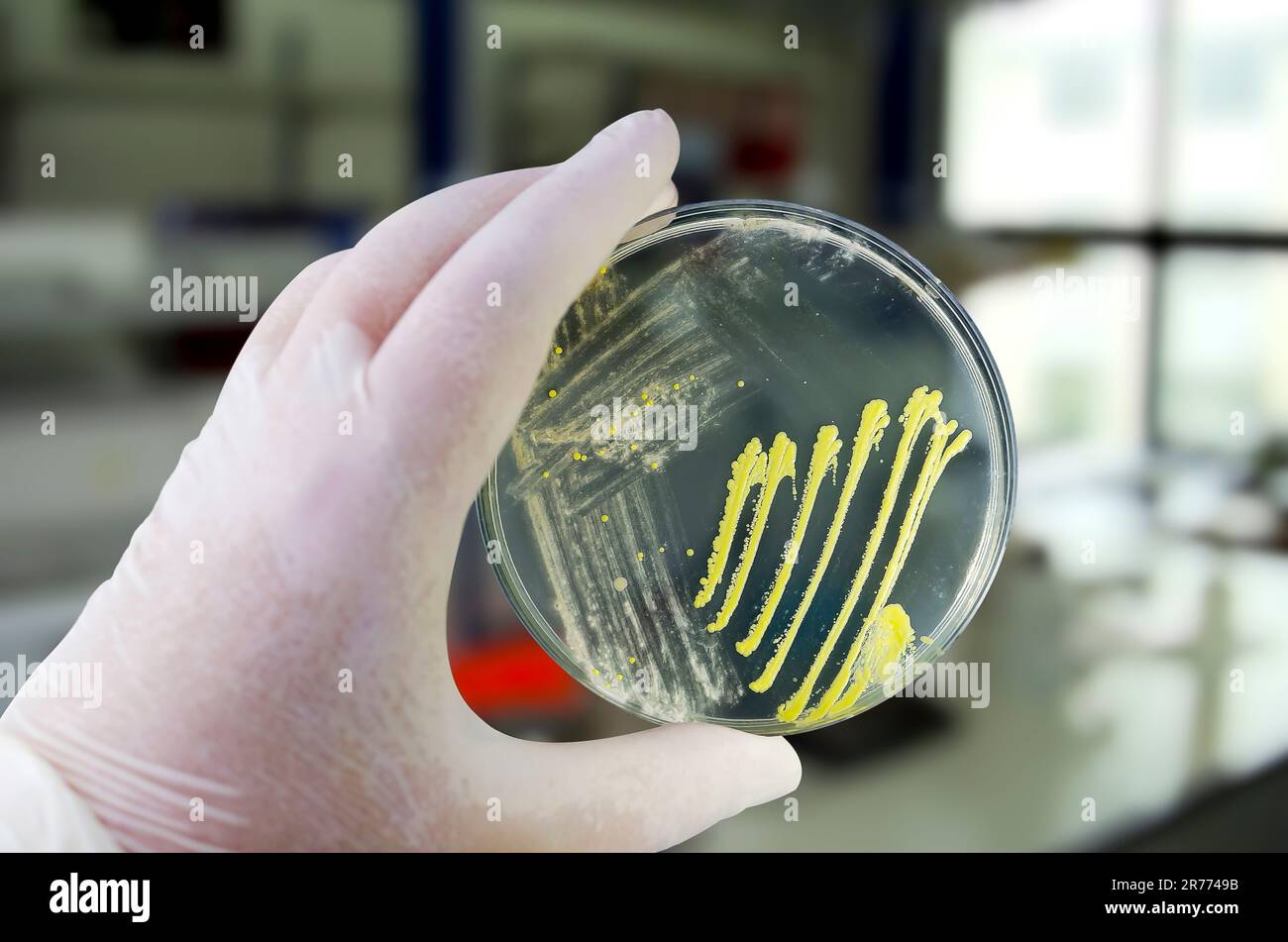 Colonies of different bacteria and mold fungi grown on Petri dish with