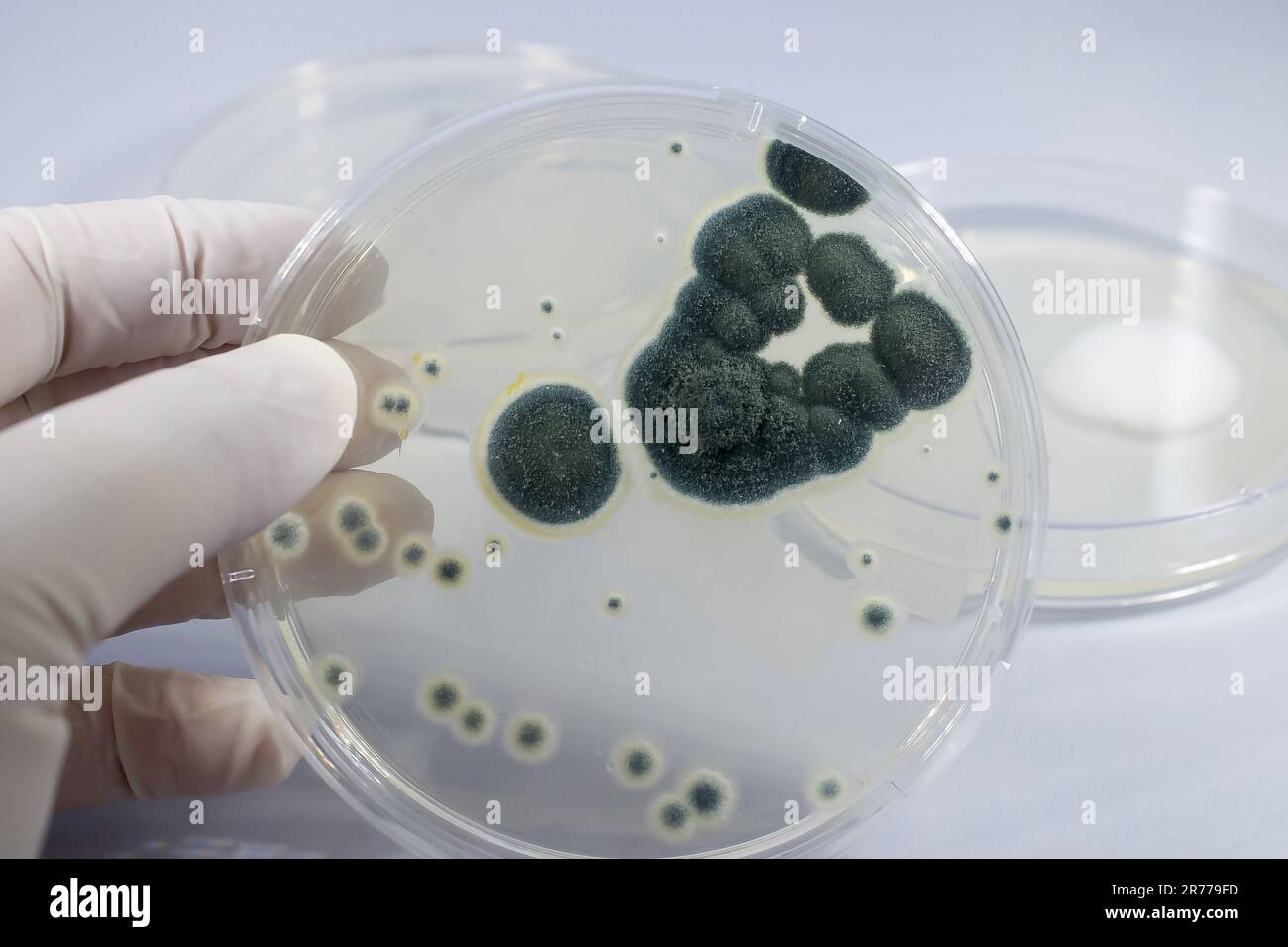 Colonies of Penicillium fungi grown on Sabouraud Dextrose Agar (SDA ...