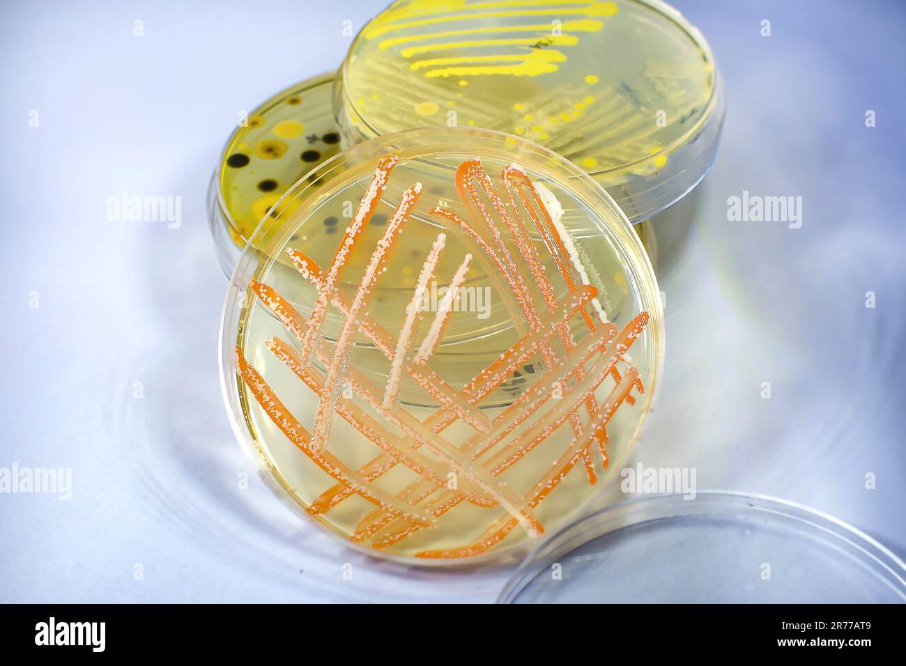 Mixed culture of bacteria and fungi of different colors grown on a