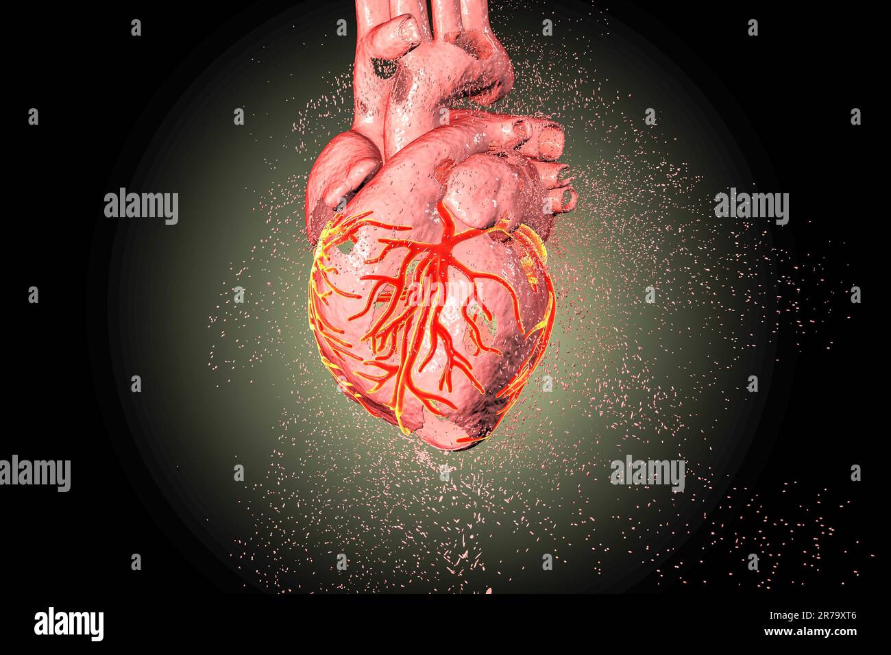 Destruction of heart. Heart disease concept, 3D illustration Stock ...